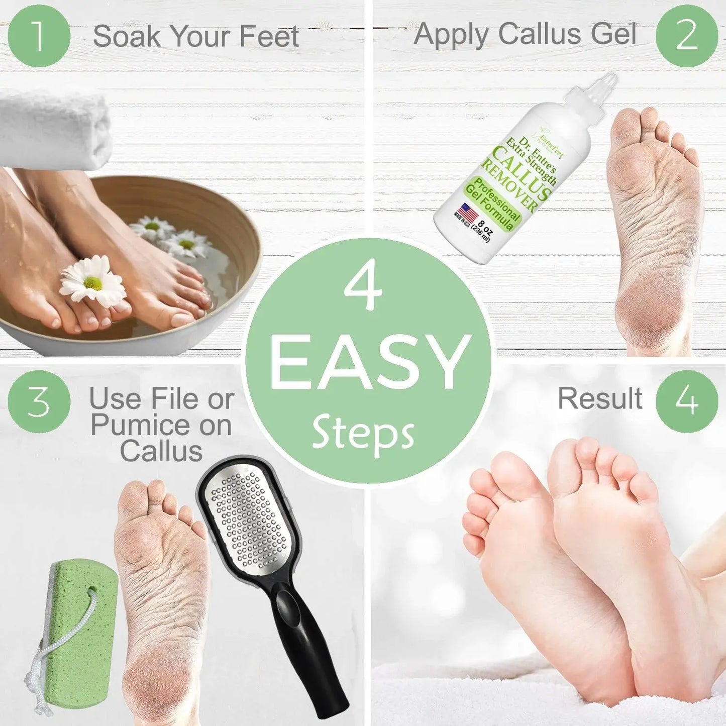 Dr. Entre'S Callus Remover for Feet: Callus Remover Gel, Foot Callus Remover, Pedicure Kit Tools Supplies, Spa Kit, Dead Skin Scrubber,